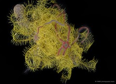Macrophiothrix sp. "cf. nereidina"•&copy; CMBS photography team•All Rights Reserved